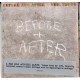 Neil Young. Cd Before after. Cd éxitos en directo
