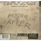 Neil Young. Cd Before after. Cd éxitos en directo